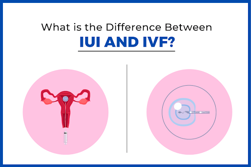 WHICH ONE SHOULD YOU OPT FOR – IVF OR IUI