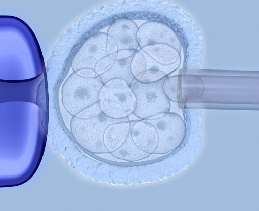 ADVANCED FERTILITY TECHNIQUES AT AARUSHIVF FERTILITY CLINIC