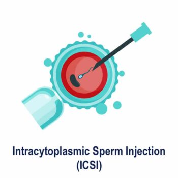 intracytoplasmic-sperm-injection_icsi